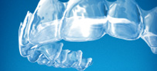 Invisalign